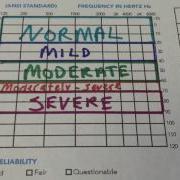 How To Read Your Audiogram