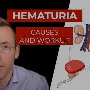 Hematuria Causes And Evaluation Of Blood In Your Urine