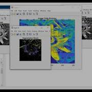 AUTOMATIC MULTISTAGE IMAGE CLUSTERING AND SEGMENTATION USING NORMALIZED CUT