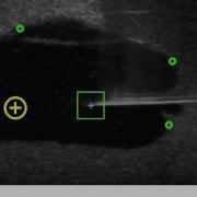 Needle And Target Tracking In Deformable Phantom