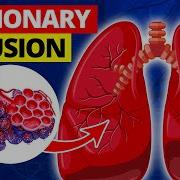 Pulmonary Diffusion Medical Definition Quick Explainer Video