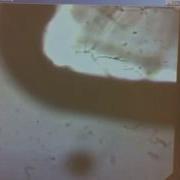 NaCl Dissolving