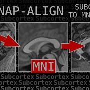 Tutorial Align Human Subcortex To MNI Space Using ITKSNAP And BrainVoyager