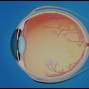 Understanding Glaucoma