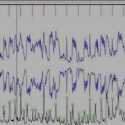 Automatic Beat Detection