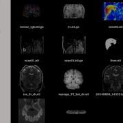 Working With Multi Component Images In ITK SNAP 3 2