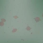 Apoptosis