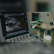 ULTRASOUND GUIDED SUPERFICIAL CERVICAL PLEXUS BLOCK