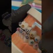 Как чистить зубы с брекетами