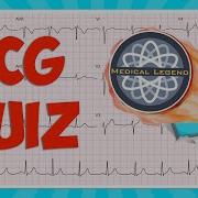 Are You A Medical Legend Test Your Knowledge With This Ecg Ekg Quiz Electrocardiogram