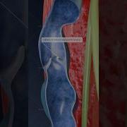 What Is Varicosity Of The Superficial Veins And How Can It Impact Your Health Explore In 3D