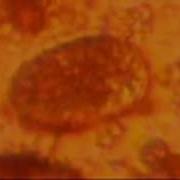 Single Cell Amoeba