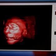 Real Time Volume Rendering Combining MPR And Ray Casting
