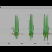 Accelerometer Data Serial At 57600 Baud