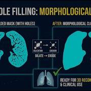 Image Processing 101 Dilation Erosion And Morphological Closing