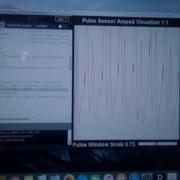 Lab 9 Exercise 3 Visualizing The Heart Beat In Processing