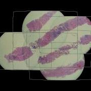 Use Cases Microscope Stitching Bundle Adjustment