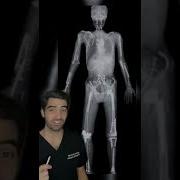 Broke Every Bone In The Body