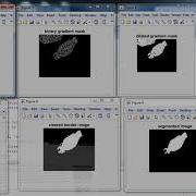 Cell Detection With AI 91 9872993883 For Query Using Image Segmentation In MATLAB