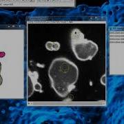Tutorial LimeSeg 1 Multiple Objects Segmentation