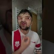 Misafirlikte Tuvalet Problemi Yaşayan Gencin Zor Anları