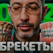 Прежде чем ставить БРЕКЕТЫ посмотри ЭТО Как выбрать брекеты в 2026
