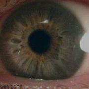 Eye Works 1 Focusing Cornea Iris And Lens