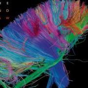 Muse Isolated System