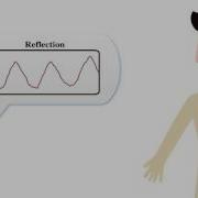 EQ Radio Emotion Recognition Using Wireless Signals