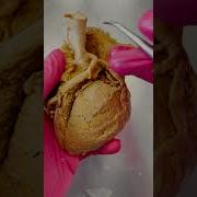 Why Aspirin Helps During A Heart Attack