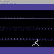 Spriteman Animation C64