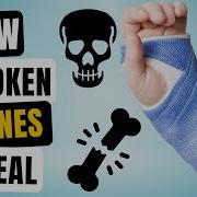 Why Do Bones Break How Do Broken Bones Heal Themselves