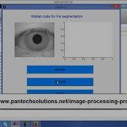 Matlab Code For Iris Segmentation