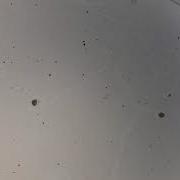 Vivo Particle Aggregation