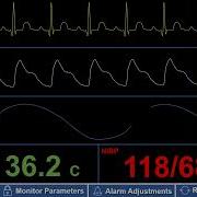 Simulated Adult Patient Monitor Low Pulse Ox