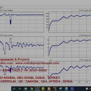 Firefly Optimization Based Maximum Power Point Tracking Technique For Solar PV System