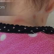 Does Swelling Redness Point Toward Spider Bite Dr Nischal K