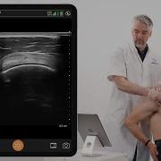 Dynamic Assessment Of Ligaments Of The Coracoid Process And Supraspinatus Tendon