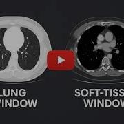 CT Window Width Window Level Explained Image Optimization Made Easy