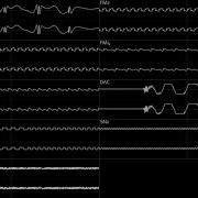FNF Vs Sonic EXE 2 0 Chaos Instrumental YM2612 SN76489 Oscilloscope View