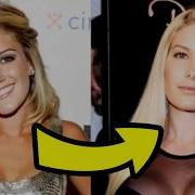 10 Celebrity Plastic Surgery Nightmares