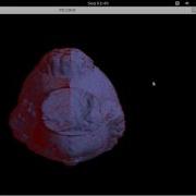 Igea Model Implicit Surface Reconstruction