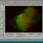 Huygens Deconvolution And Fusion Of Light Sheet Data Short Introduction