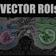 FireVoxel Tutorial 4 Vector ROIs