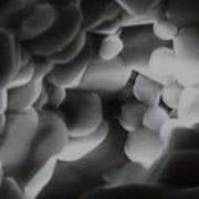 Profs Microstructure