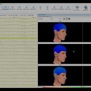 BSCIA Raw EEG 3D Screen View