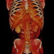 Abdomen Volume Rendering