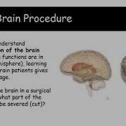 Lateralization And Split Brain Procedures