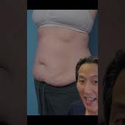 Tummy Tuck REVEAL Shorts Tummytuck