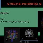 Diffusion Tensor Imaging DTI TRACTOGRAPHY